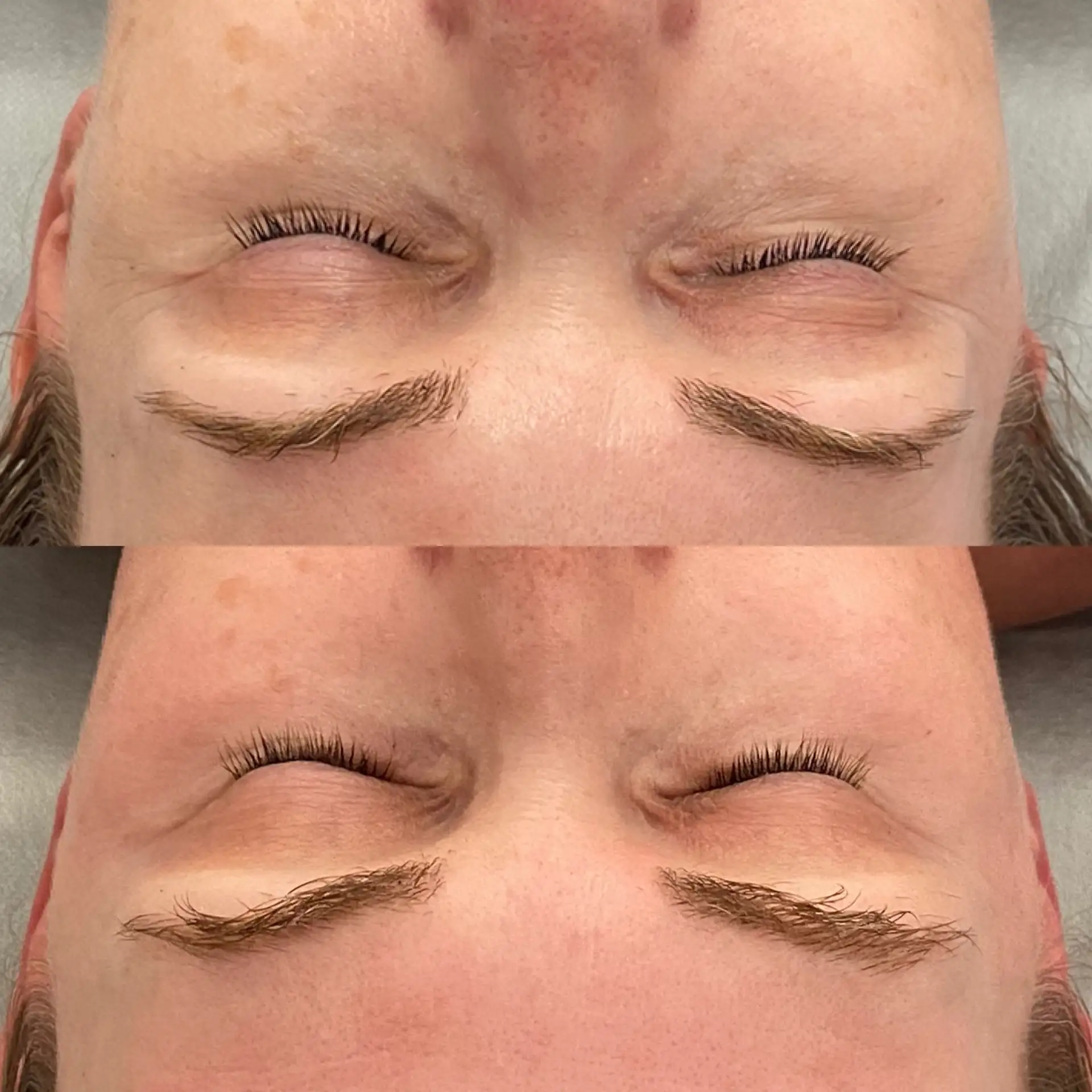 Terapia twarzy wygładzenie i rozświetlenie Płock