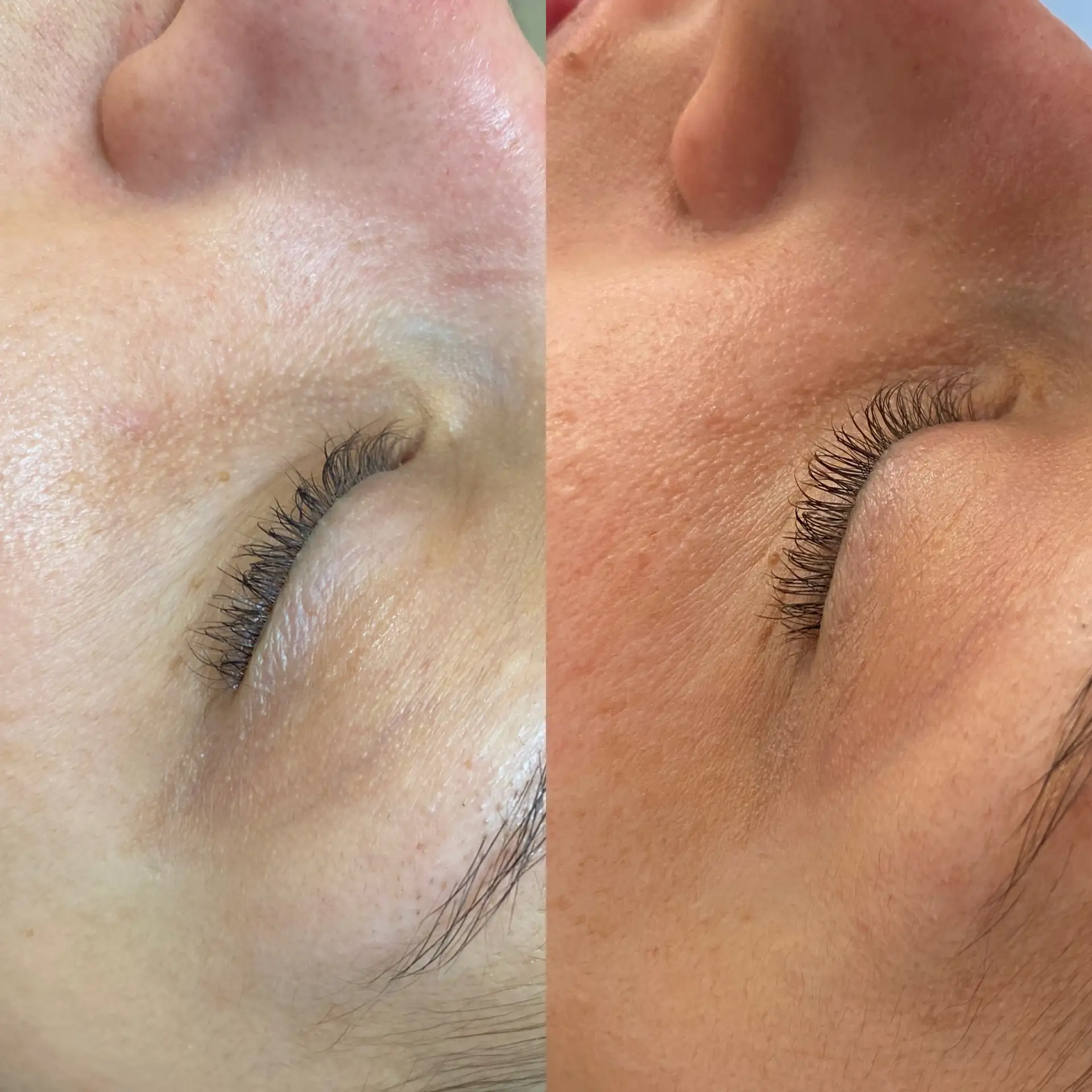 Zabieg pielęgnacyjny nawilżenie skóry Płock